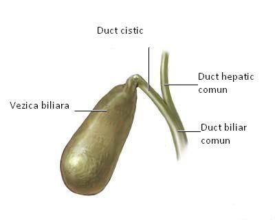 poza despre calculi biliari